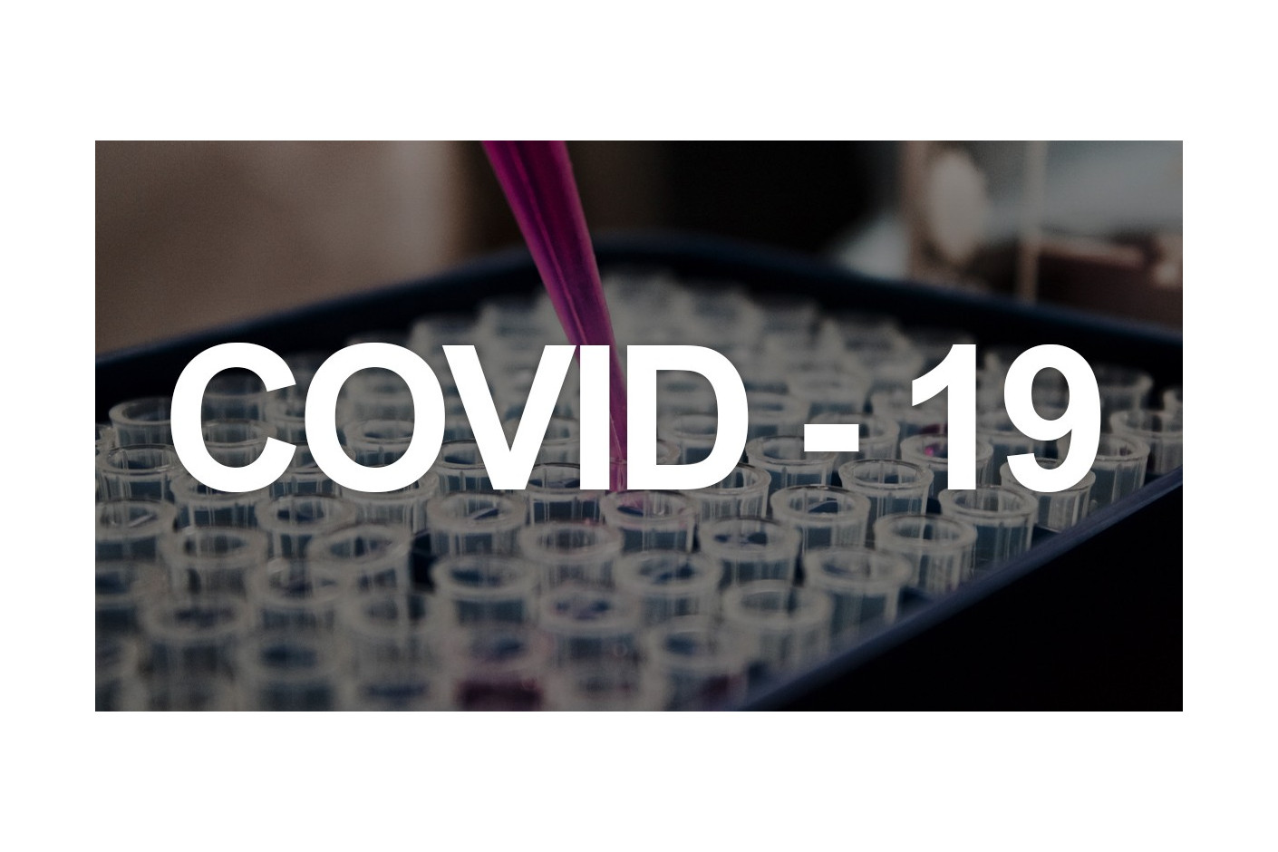 5 SAVETA ZA JACANJE IMUNITETA U PERIODU VIRUSA COVID19