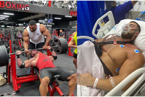 Bodybuilder Ryan Crowley imao je uspešnu operaciju nakon razorne povrede Pectoralisa