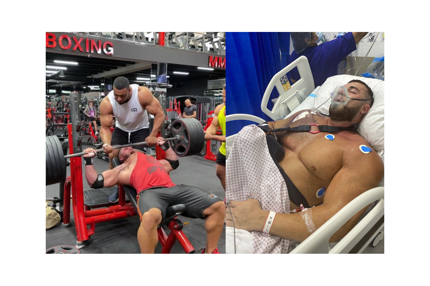 Bodybuilder Ryan Crowley imao je uspešnu operaciju nakon razorne povrede Pectoralisa